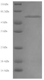Greater than 90% as determined by SDS-PAGE.Recombinant Human Mixed Lineage Kinase Domain-Like Protein (MLKL) Protein (His)