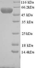 Greater than 90% as determined by SDS-PAGE.Recombinant Human E3 Ubiquitin-Protein Ligase Mylip (MYLIP) Protein (His)