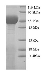 Greater than 90% as determined by SDS-PAGE.