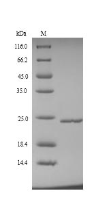 Greater than 90% as determined by SDS-PAGE.Recombinant Human Metalloproteinase Inhibitor 4 (TIMP4) Protein (His)