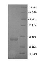Greater than 90% as determined by SDS-PAGE.Recombinant Staphylococcus Aureus Staphopain B (SSPB) Protein (His)