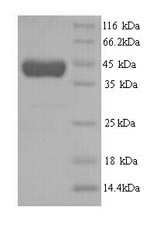 Greater than 90% as determined by SDS-PAGE.Recombinant Human Methionine Synthase (MTR) Protein (His)