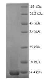 Greater than 90% as determined by SDS-PAGE.Recombinant Mouse Nogo-B Receptor (NUS1) Protein (His)