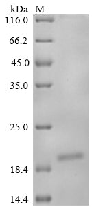 Greater than 90% as determined by SDS-PAGE.Recombinant Mouse Nogo-B Receptor (NUS1) Protein (His)