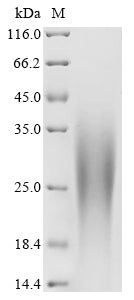 Greater than 90% as determined by SDS-PAGE.Recombinant Human Palmitoyltransferase Zdhhc5 (ZDHHC5) Protein (His)