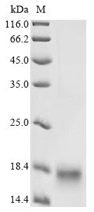 Greater than 85% as determined by SDS-PAGE.Recombinant Mouse Lymphocyte Antigen 6K (LY6K) Protein (His)