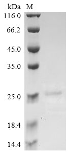 Greater than 90% as determined by SDS-PAGE.Recombinant Mouse Apoptosis-Associated Speck-Like Protein Containing A Card (PYCARD) Protein (His)