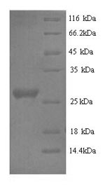 Greater than 90% as determined by SDS-PAGE.