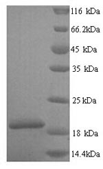 Greater than 90% as determined by SDS-PAGE.Recombinant Human Group Xiia Secretory Phospholipase A2 (PLA2G12A) Protein (His)