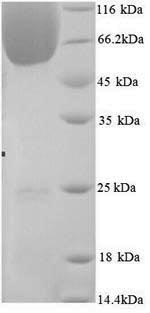 Greater than 90% as determined by SDS-PAGE.Recombinant Mouse Bag Family Molecular Chaperone Regulator 3 (BAG3) Protein (His)