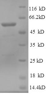 Greater than 90% as determined by SDS-PAGE.Recombinant Human Cytosolic 5'-Nucleotidase 1A (NT5C1A) Protein (His)