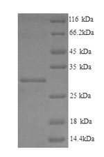 Greater than 90% as determined by SDS-PAGE.Recombinant Human Phospholysine Phosphohistidine Inorganic Pyrophosphate Phosphatase (LHPP) Protein (His)