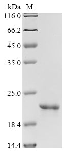 Greater than 85% as determined by SDS-PAGE.Recombinant Human Gastrokine-1 (GKN1) Protein (His)