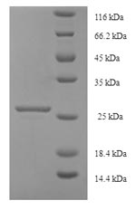 Greater than 90% as determined by SDS-PAGE.Recombinant Human Uncharacterized Protein Kiaa1377 (CEP126) Protein (His-SUMO)