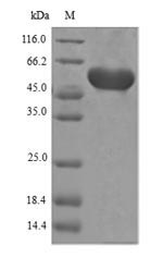 Greater than 90% as determined by SDS-PAGE.Recombinant Agrobacterium Sp.3-Phosphoshikimate 1-Carboxyvinyltransferase (AROA) Protein (His)