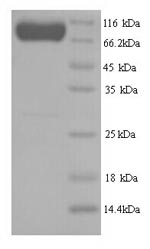 Greater than 90% as determined by SDS-PAGE.Recombinant Human E3 Ubiquitin-Protein Ligase Smurf2 (SMURF2) Protein (His)