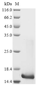 Greater than 85% as determined by SDS-PAGE.Recombinant Human Interleukin-21 (IL21) Protein (His)