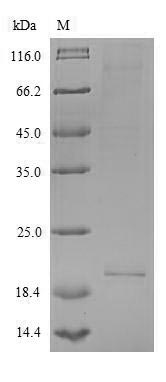 Greater than 90% as determined by SDS-PAGE.Recombinant Human Interleukin-26 (IL26) Protein (His)