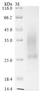 Greater than 85% as determined by SDS-PAGE.Recombinant Mouse Collagen Triple Helix Repeat-Containing Protein 1 (CTHRC1) Protein (His)