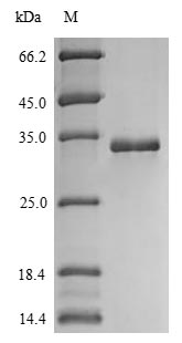 Greater than 85% as determined by SDS-PAGE.Recombinant Human Protein S100-A14 (S100A14) Protein (His-sumostar)