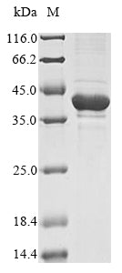 Greater than 85% as determined by SDS-PAGE.Recombinant Arabidopsis Thaliana Beta-Amylase 1, Chloroplastic (BAM1) Protein (His)