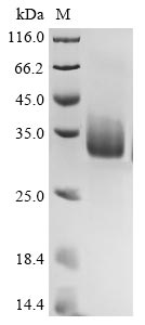 Greater than 90% as determined by SDS-PAGE.Recombinant Bovine Coronavirus Spike Glycoprotein (S) Protein (His)