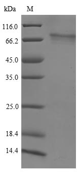 Greater than 85% as determined by SDS-PAGE.Recombinant Human Histone-Lysine N-Methyltransferase Nsd3 (NSD3) Protein (His)