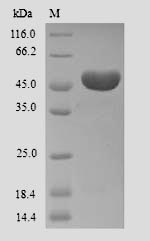 Greater than 90% as determined by SDS-PAGE.Recombinant Human Ameloblastin (AMBN) Protein (His)