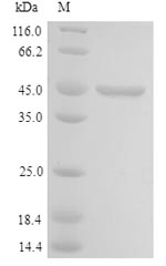 Greater than 90% as determined by SDS-PAGE.Recombinant Human Cell Growth-Regulating Nucleolar Protein (LYAR) Protein (His)