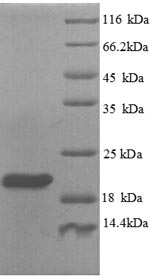 Greater than 90% as determined by SDS-PAGE.Recombinant Human Plexin-A1 (PLXNA1) Protein (His)