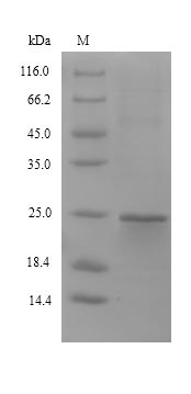 Greater than 90% as determined by SDS-PAGE.Recombinant Mouse Stromal Cell-Derived Factor 2-Like Protein 1 (SDF2L1) Protein (His&Myc)