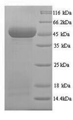 Greater than 90% as determined by SDS-PAGE.Recombinant Human Protein Wnt-10A (WNT10A) Protein (His)