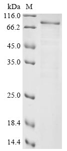 Greater than 85% as determined by SDS-PAGE.Recombinant Human Xylosyltransferase 2 (XYLT2) Protein (His)
