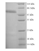Greater than 90% as determined by SDS-PAGE.Recombinant Mouse Receptor-Interacting Serine/Threonine-Protein Kinase 3 (RIPK3) Protein (His)