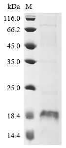 Greater than 90% as determined by SDS-PAGE.Recombinant Human Microtubule-Associated Proteins 1A/1B Light Chain 3B (MAP1LC3B) Protein (His)