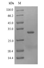 Greater than 90% as determined by SDS-PAGE.Recombinant Charybdis Feriata Tropomyosin Protein (His)