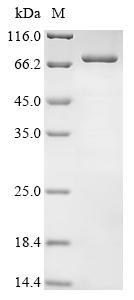 Greater than 90% as determined by SDS-PAGE.Recombinant Human Interferon Kappa (IFNK) Protein (His-PDI)