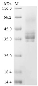 Greater than 85% as determined by SDS-PAGE.Recombinant Human Methyl-Cpg-Binding Domain Protein 2 (MBD2) Protein (hFc)