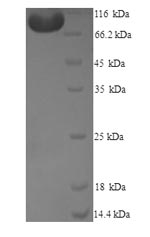 Greater than 90% as determined by SDS-PAGE.Recombinant Human Methionine Synthase Reductase (MTRR) Protein (His)