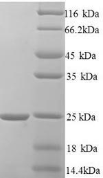 Greater than 90% as determined by SDS-PAGE.Recombinant Human Hematological And Neurological Expressed 1 Protein (JPT1) Protein (His)