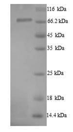 Greater than 90% as determined by SDS-PAGE.Recombinant Human Protein-Arginine Deiminase Type-1 (PADI1) Protein (His)