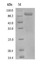 Greater than 90% as determined by SDS-PAGE.Recombinant Human Protein-Arginine Deiminase Type-3 (PADI3) Protein (His)