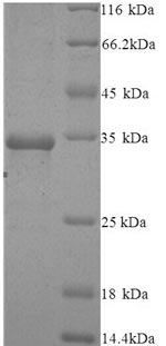 Greater than 90% as determined by SDS-PAGE.Recombinant Human Protein Argonaute-2 (AGO2) Protein (His)