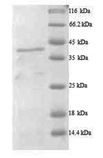 Greater than 90% as determined by SDS-PAGE.Recombinant Human A Disintegrin And Metalloproteinase With Thrombospondin Motifs 7 (ADAMTS7) Protein (His)