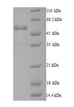 Greater than 90% as determined by SDS-PAGE.Recombinant Human Dynactin Subunit 4 (DCTN4) Protein (His)