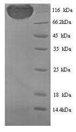 Greater than 90% as determined by SDS-PAGE.Recombinant Rat Podocalyxin (PODXL) Protein (His)
