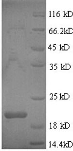 Greater than 90% as determined by SDS-PAGE.Recombinant Drosophila Melanogaster Bursicon (BURS) Protein (His)