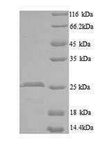 Greater than 90% as determined by SDS-PAGE.Recombinant Mouse Ccn Family Member 5 (CCN5) Protein (His)