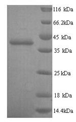 Greater than 90% as determined by SDS-PAGE.Recombinant Human Talin-2 (TLN2) Protein (His)