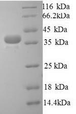 Greater than 90% as determined by SDS-PAGE.Recombinant Human Talin-1 (TLN1) Protein (His)